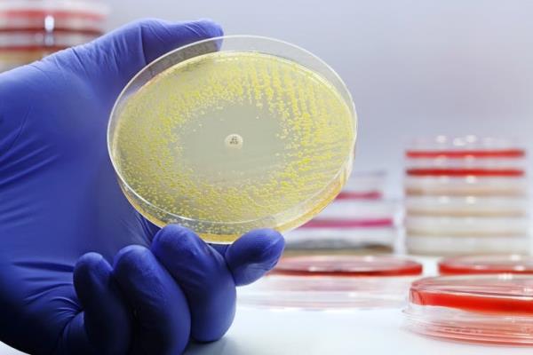 A gloved hand holding a petri dish with an antiobiotic resistance test, and a stack of petri dishes in background